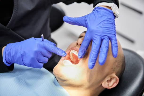 Best Emergency Wisdom Teeth Removal in Oakville, MO